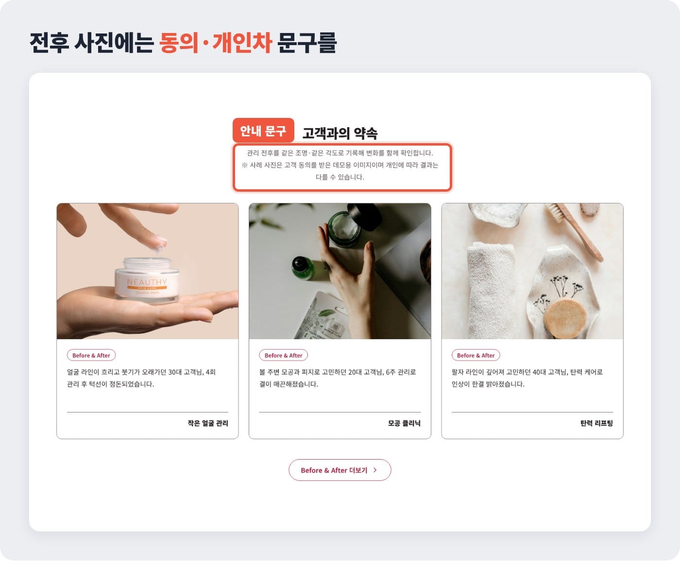 관리 전후 사례 위에 고객 동의와 개인차 안내 문구가 적힌 에스테틱 홈페이지 화면 ©잇다웹